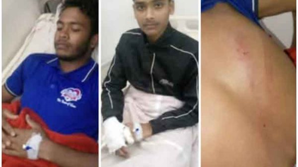 শিবির নেতা গুরুতর আহত