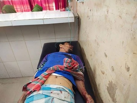 দূর্ঘটনায় কবলিত ব্যাক্তি