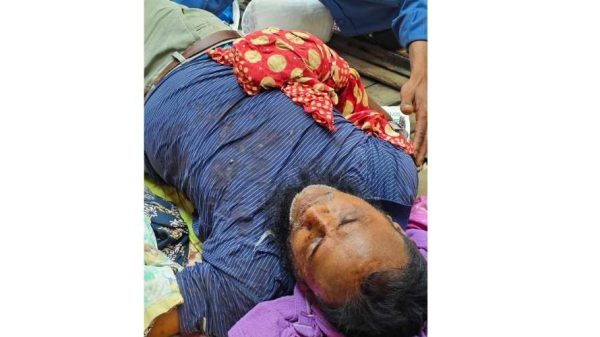 গাছ কাটাকে কেন্দ্র করে সংঘর্ষে আহত-১