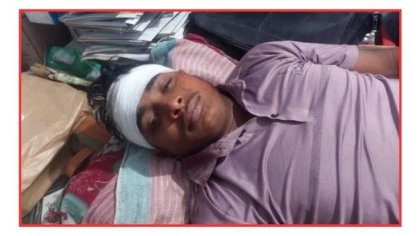 পিরোজপুরে বৈষম্যবিরোধী আন্দোলনে চোখ হারানো ফরিদক
