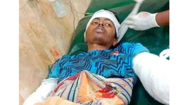 নাটোরে পারিবারিক বিবাদের জেরে দুই হাত হারালেন যুবক ইসরাফিল ইসলাম।
