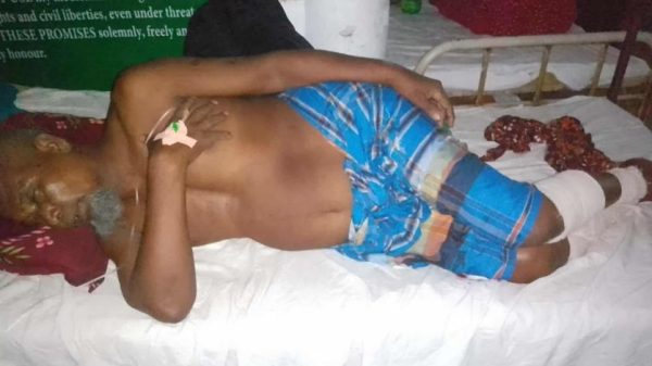 ঝিনাইদহের শৈলকুপায় প্রতিপক্ষের হামলায় ক্ষুদ্র ব্যবসায়ী আব্দুল জলিল মোল্লার পায়ের রগ কেটে দেওয়া হয়েছে। গুরুতর অবস্থায় তাকে ঢাকায় পাঠানো হয়েছে।