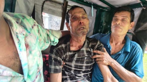 পিরোজপুরের ইন্দুরকানীতে সুপারি পাড়া নিয়ে পারিবারিক বিরোধের জেরে ভাতিজার দায়ের কোপে চাচা ধীরেন্দ্র নাথ বৌদ্ধ গুরুতর আহত হয়েছেন। পুলিশ বলছে, লিখিত অভিযোগ পেলে আইনগত ব্যবস্থা নেওয়া হবে।
