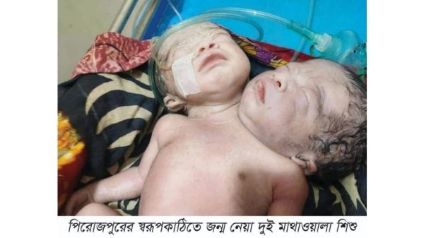 পিরোজপুরের নেছারাবাদে একই দেহে দুটি মাথা বিশিষ্ট নবজাতকের জন্ম দিয়েছে এক মা। চিকিৎসকরা একে ‘কনজয়েনড টুইন’ বলেছেন। বিরল এ ঘটনায় এলাকায় চাঞ্চল্যের সৃষ্টি হয়েছে।