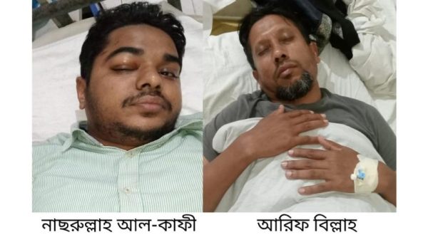 পিরোজপুরের ইন্দুরকানীতে সংবাদ সংগ্রহের সময় দুর্বৃত্তদের হামলায় দুই সাংবাদিক আহত হয়েছেন। তাদের মোবাইল, মাইক্রোফোন ও সরঞ্জাম ছিনিয়ে নেওয়া হয়েছে। বর্তমানে দু’জনই জেলা হাসপাতালে চিকিৎসাধীন। পুলিশ অভিযোগ পেলে আইনানুগ ব্যবস্থা নেবে।