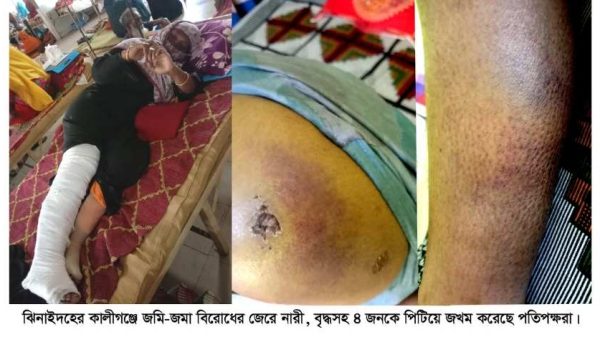 ঝিনাইদহের কালীগঞ্জে জমি-জমা বিরোধের জেরে নারী ও বৃদ্ধসহ চারজনকে পিটিয়ে জখম করেছে প্রতিপক্ষরা। এ ঘটনায় থানায় মামলা দায়ের করেছেন ভুক্তভোগী পরিবার। পুলিশ জানিয়েছে, তদন্ত শেষে ব্যবস্থা নেওয়া হবে।